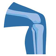 Salud de las articulaciones y los bonos