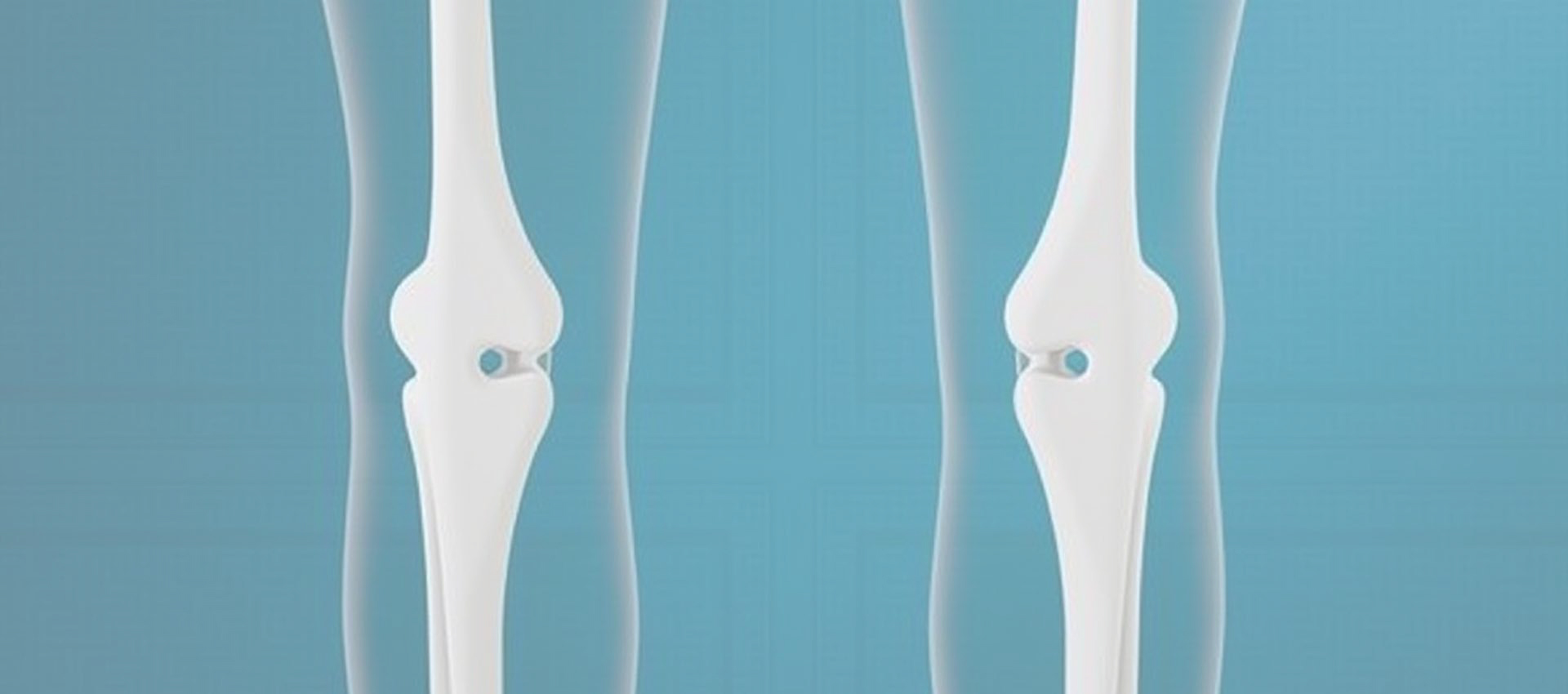 Vitamina liposomal D3