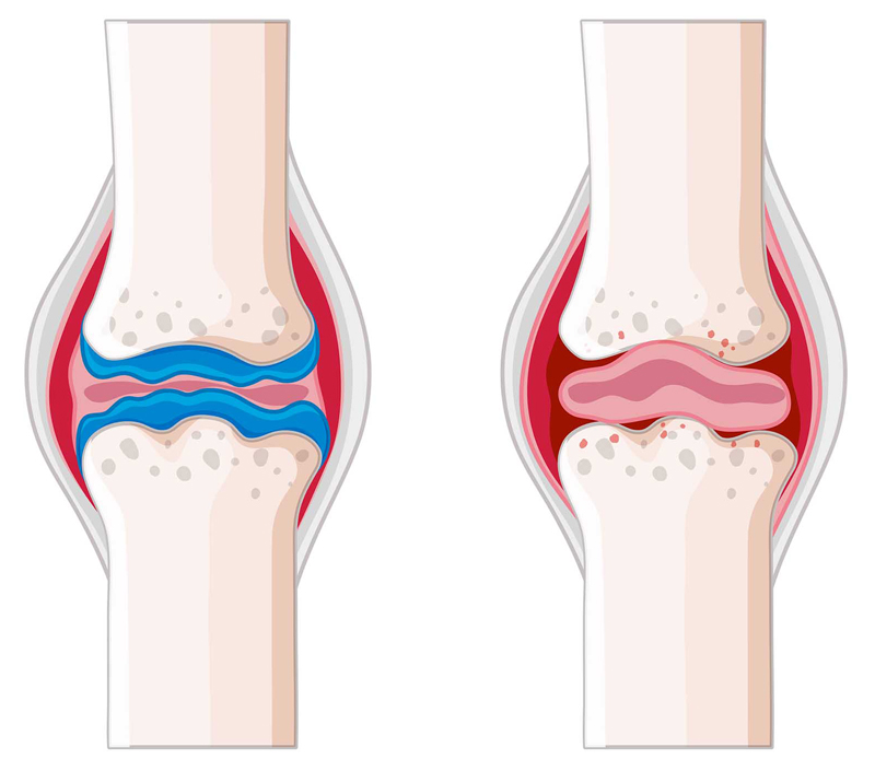 Promueve la salud ósea y cardiovascular